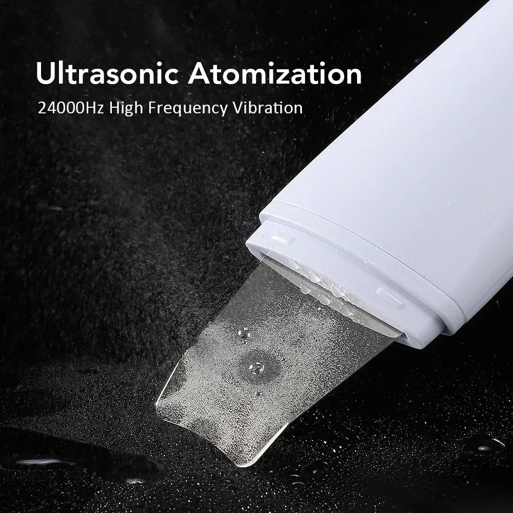 Ultrasonic Skin Scrubber Ion Deep Cleansing Facial Device - Urbizia