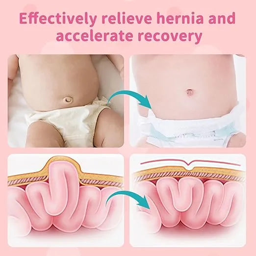 Umbilical Hernia Belt for Babies – Pink (14–21 inch) - Urbizia