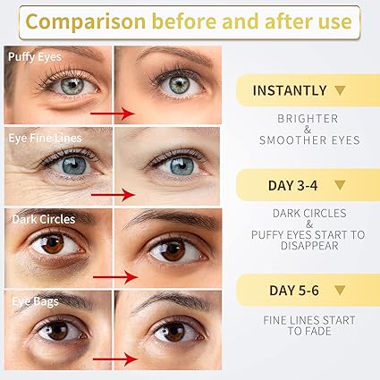 24K Gold Under Eye Patches – Collagen & Hyaluronic Acid (60 Pack) - Urbizia