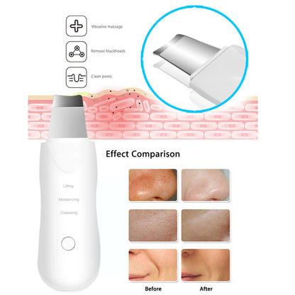Ultrasonic Skin Scrubber Facial Deep Cleaning Device