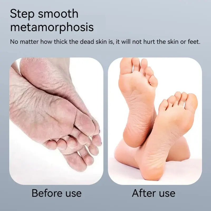 Automatic Callus Grinding and Pedicure Machine