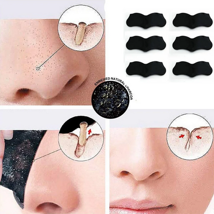 Nose Blackhead Remover Mask Strips