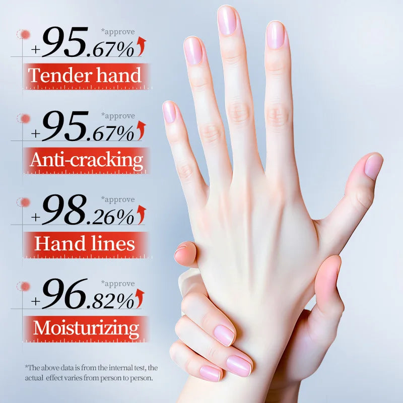 3/5pcs SADOER 10% Urea Anti-Cracking Hand Cream Panthenol HA Deep Moisturizing Improve Dryness Repair Cracked Hands Skincare 30g