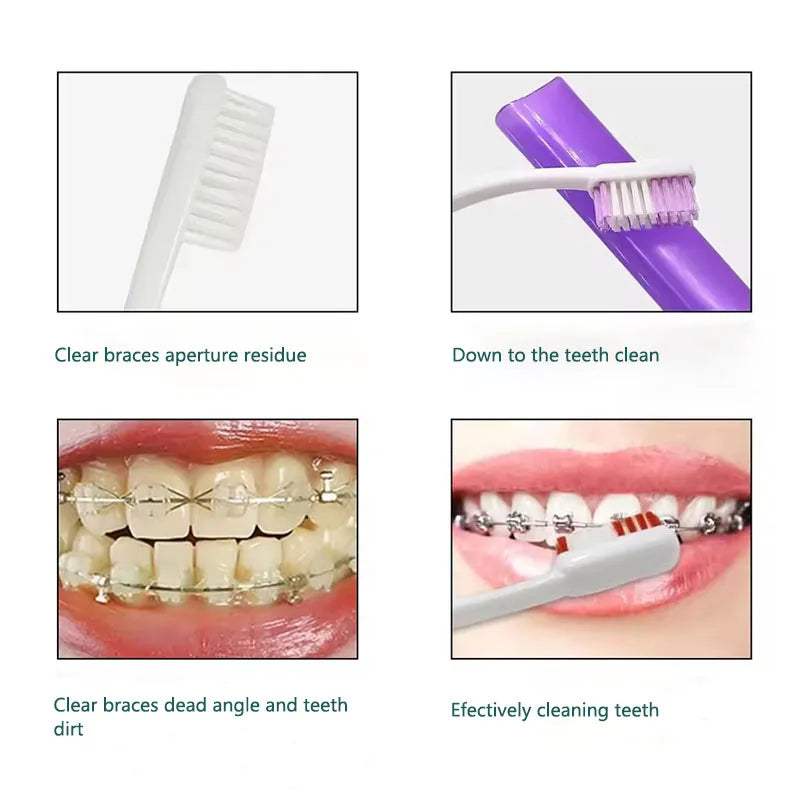 8Pcs Orthodontic Dental Care Brush Kit Teeth Cleaning Braces Toothbrush with Interdental Brush Floss Thread Ortho Wax Travel Kit
