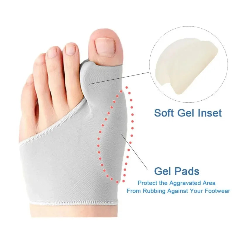 Hallux Valgus Bunion Corrector Toe Separator – Foot Alignment & Pain Relief