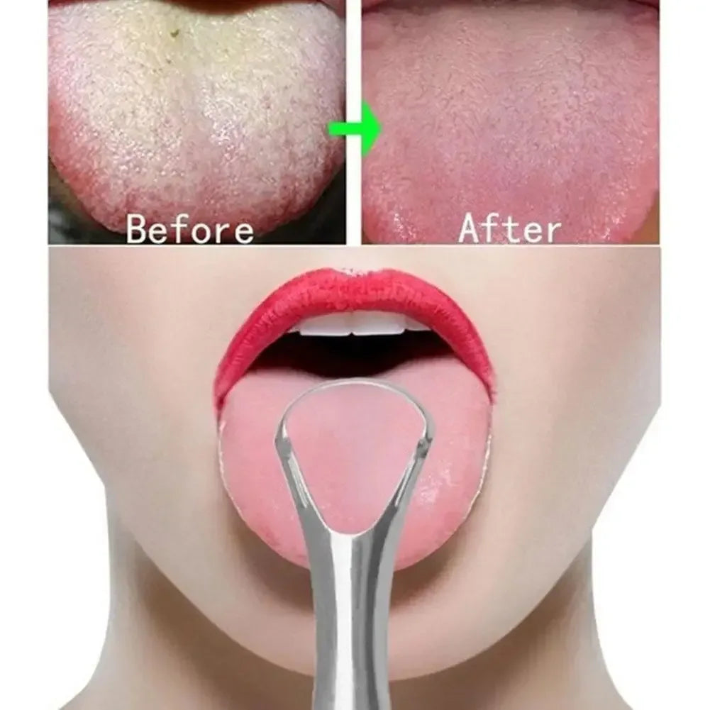 Portable Stainless Steel Tongue Scraper - Urbizia