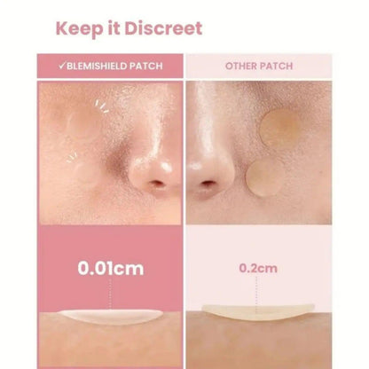 40PCS Star Acne Patches Ultra-Thin Concealer