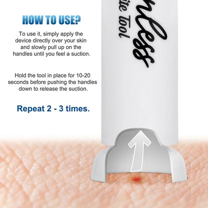Suction Tool, Poison Remover - Bug Bites And Bee/Wasp Stings, Natural Insect Bite Relief, Chemical Free Single