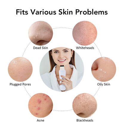 Ultrasonic Skin Scrubber Ion Deep Cleansing Facial Device