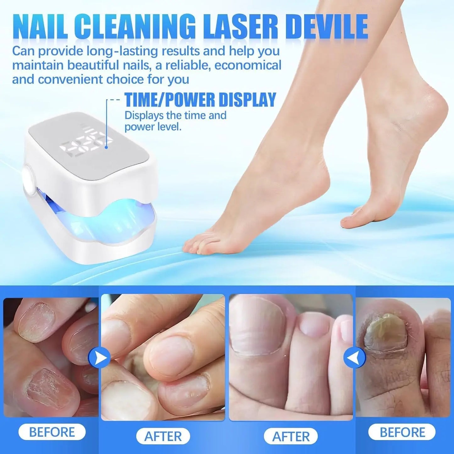 Laser Nail Fungus Device
