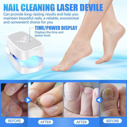 Laser Nail Fungus Device