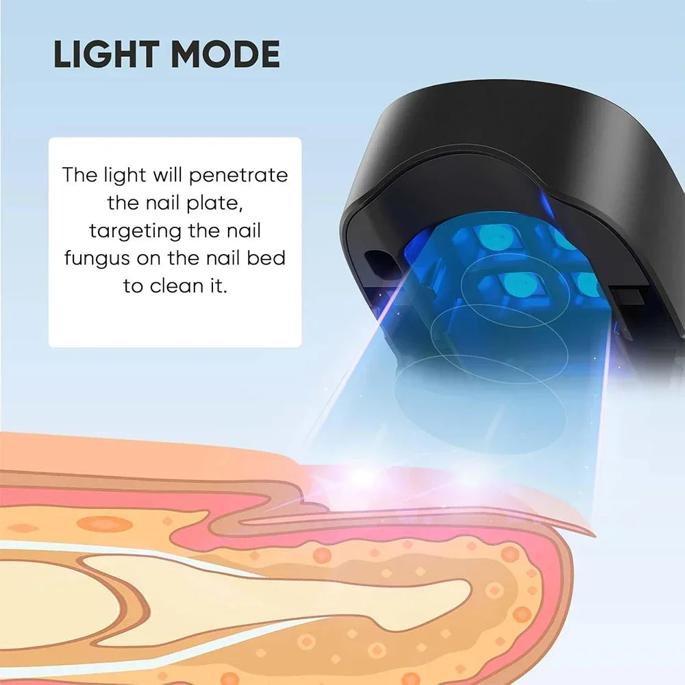 Nail Fungus Cleaning Laser Device – Infrared & Blue Light Therapy