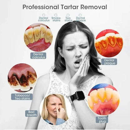 3-in-1 USB Rechargeable Sonic Electric Toothbrush – Tartar Removal & Whitening