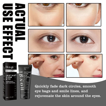Instant Collagen Firming Eye Cream,Instant Firming&Lifting,Hydrolyzed Collagen Boost,Quickly Reduce Puffiness&Fade Dark Circles,Long Lasting Hydration&Barrier Moisture Retention,Instant&Long Term Anti Aging,Gentle & For All S
