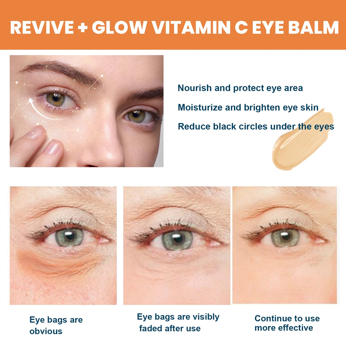 Vitamin C Eye Balm – Reduce Dark Circles & Fine Lines