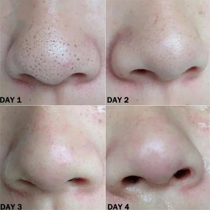 Nose Blackhead Remover Mask Strips