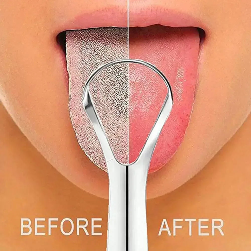 Portable Stainless Steel Tongue Scraper - Urbizia