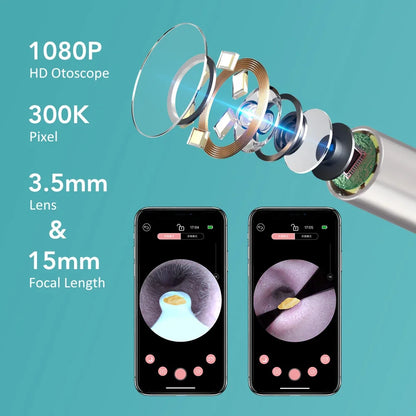 Electric Visual Ear Cleaner with Tweezers 2 in 1 Ear Wax Removal Tool with Camera Rechargeable Ear Pick for Adults Kids Black