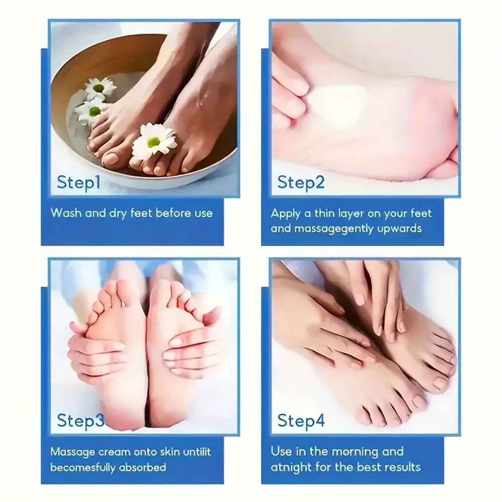 SUYARUN 60% Urea Foot Cream for Cracked Heels & Dry Skin