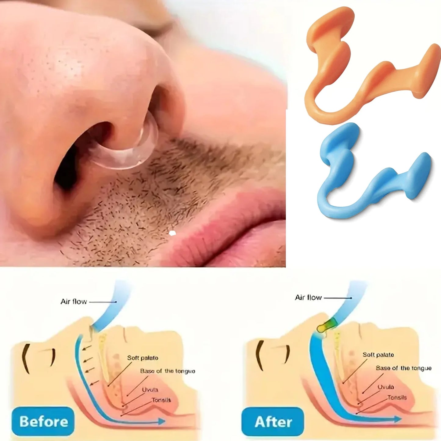 Silicone Nose Clip Anti-Snoring Nasal Dilator for Sleeping Breath Easier Snore Right Nasal Clip Improve Respiratory Comfort