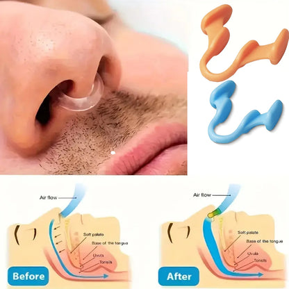 Silicone Nose Clip Anti-Snoring Nasal Dilator for Sleeping Breath Easier Snore Right Nasal Clip Improve Respiratory Comfort