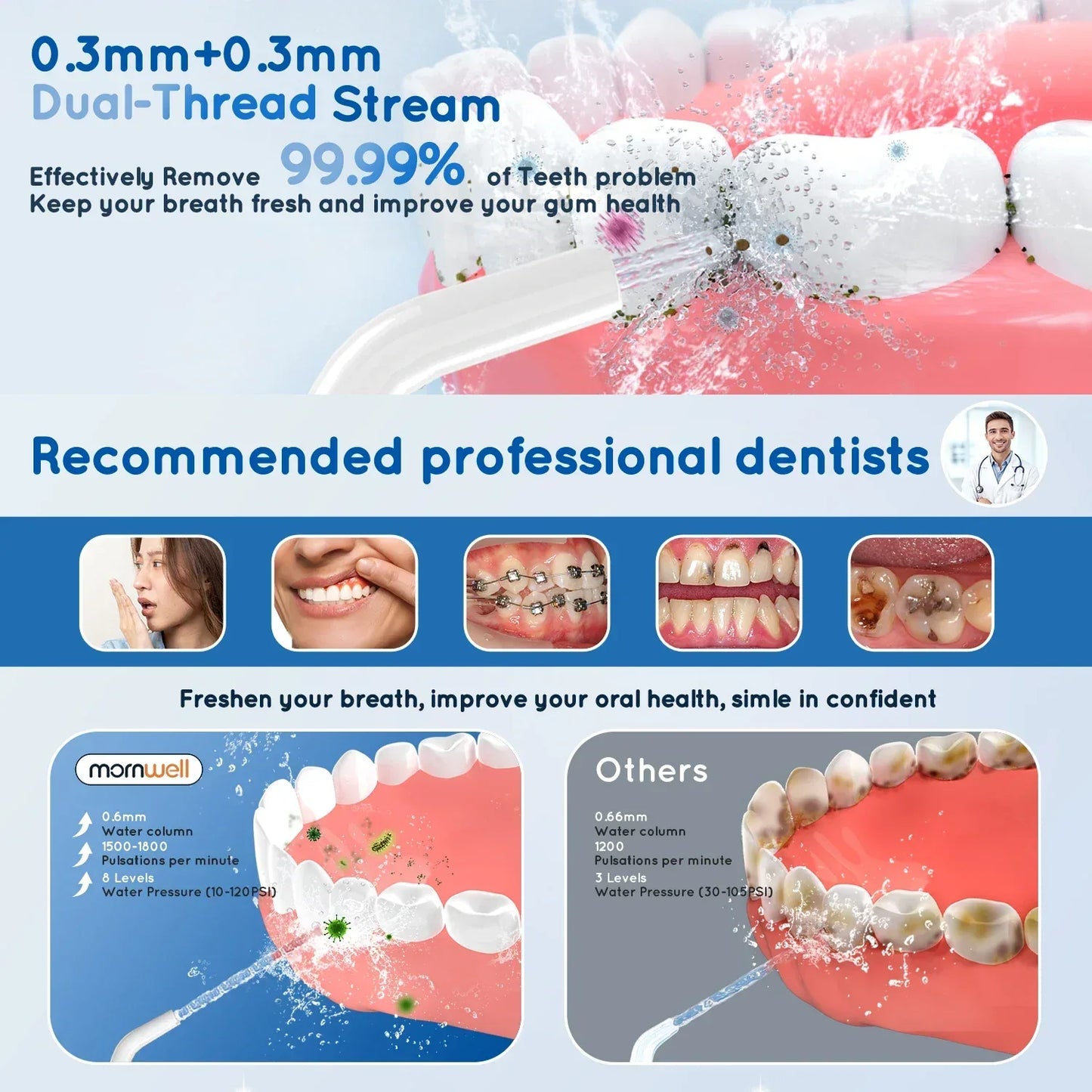 D52 Portable Cordless Water Flosser USB Rechargeable Water Jet Floss Tooth Pick 4 Jet Tip 300ml 3 Modes Teeth Clean for Travel - Urbizia