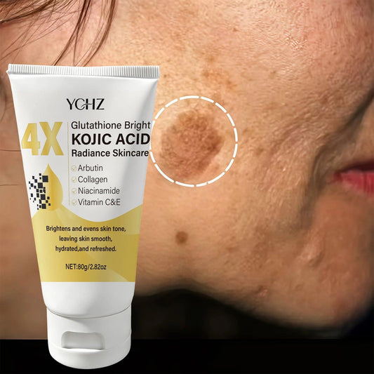Kojic Acid Whitening Face Cream – Dark Spot Removal, 80g, Unisex