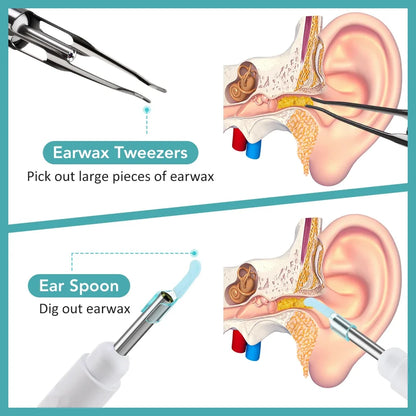 Electric Visual Ear Cleaner with Tweezers 2 in 1 Ear Wax Removal Tool with Camera Rechargeable Ear Pick for Adults Kids Black
