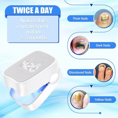 Laser Nail Fungus Device