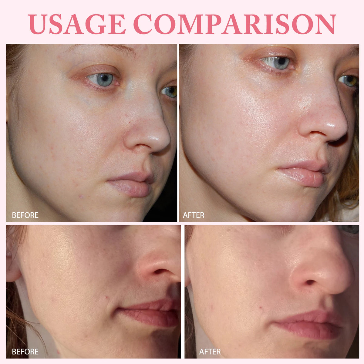 30pcs/Box PDRN Pink One Day Serum Deep Moisturizing,Repairs,Brightens,Reduces Sagging Skin Care Essence Multi-effect Benefits