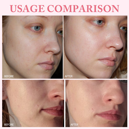 30pcs/Box PDRN Pink One Day Serum Deep Moisturizing,Repairs,Brightens,Reduces Sagging Skin Care Essence Multi-effect Benefits