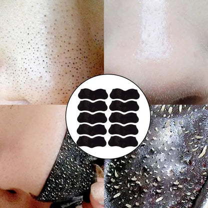 Nose Blackhead Remover Mask Strips