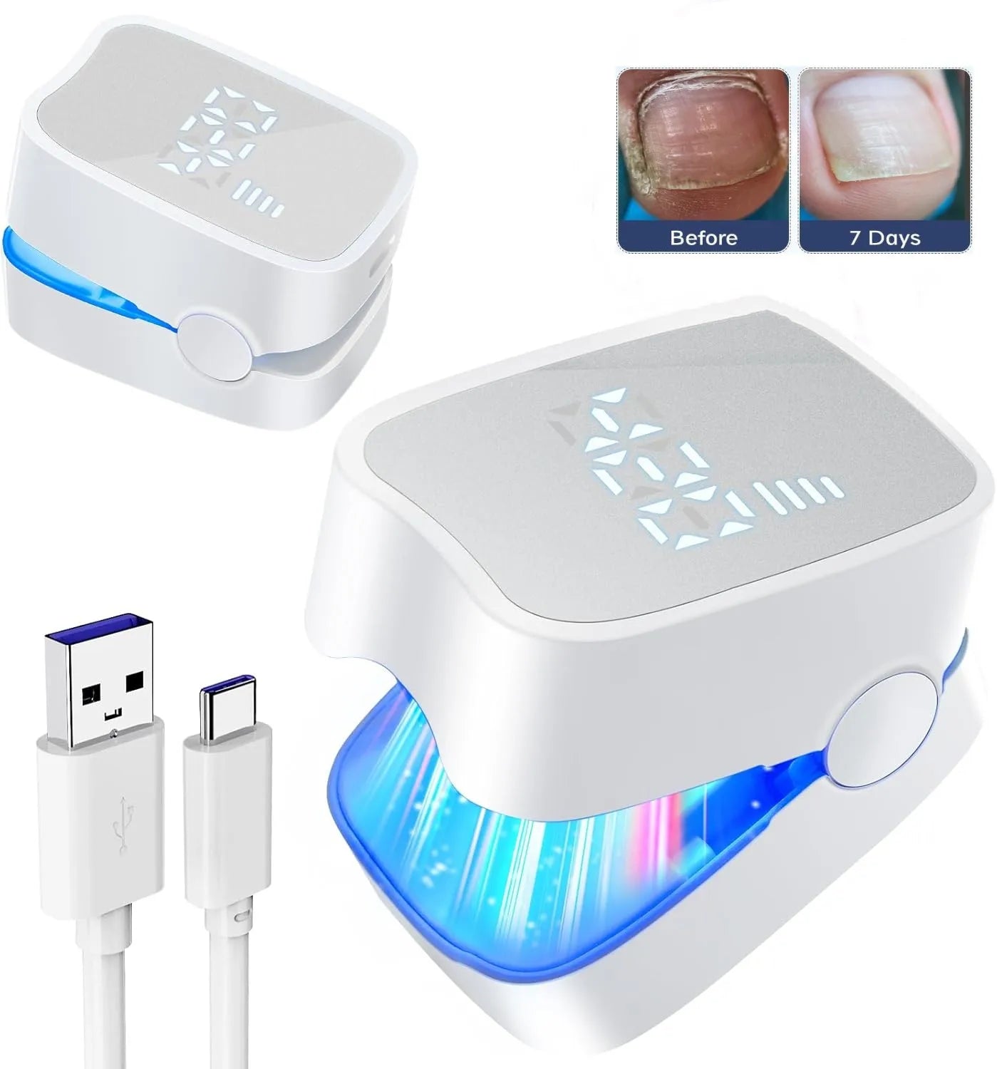 Laser Nail Fungus Device