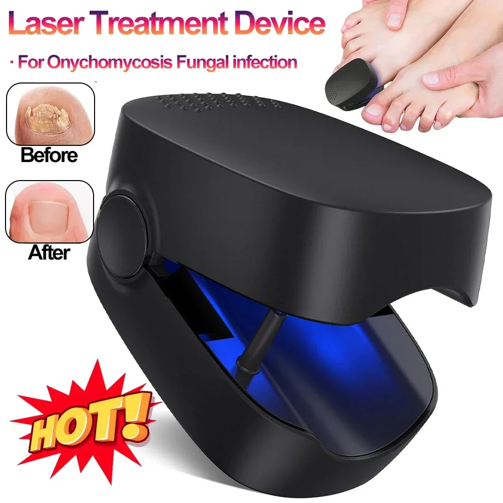 Nail Fungus Cleaning Laser Device – Infrared & Blue Light Therapy