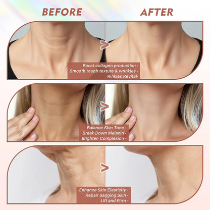 Neck LED Lift Mask Photon Anti-Wrinkle Skin Tightening Neck Beauty Device Skin Brighten Rejuvenation Neck Wrinkle Remover