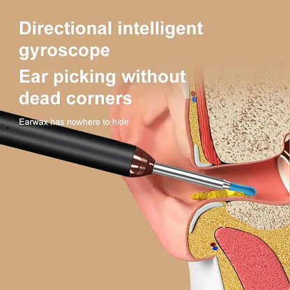 Smart Visual Ear Cleaner with HD Camera & WiFi