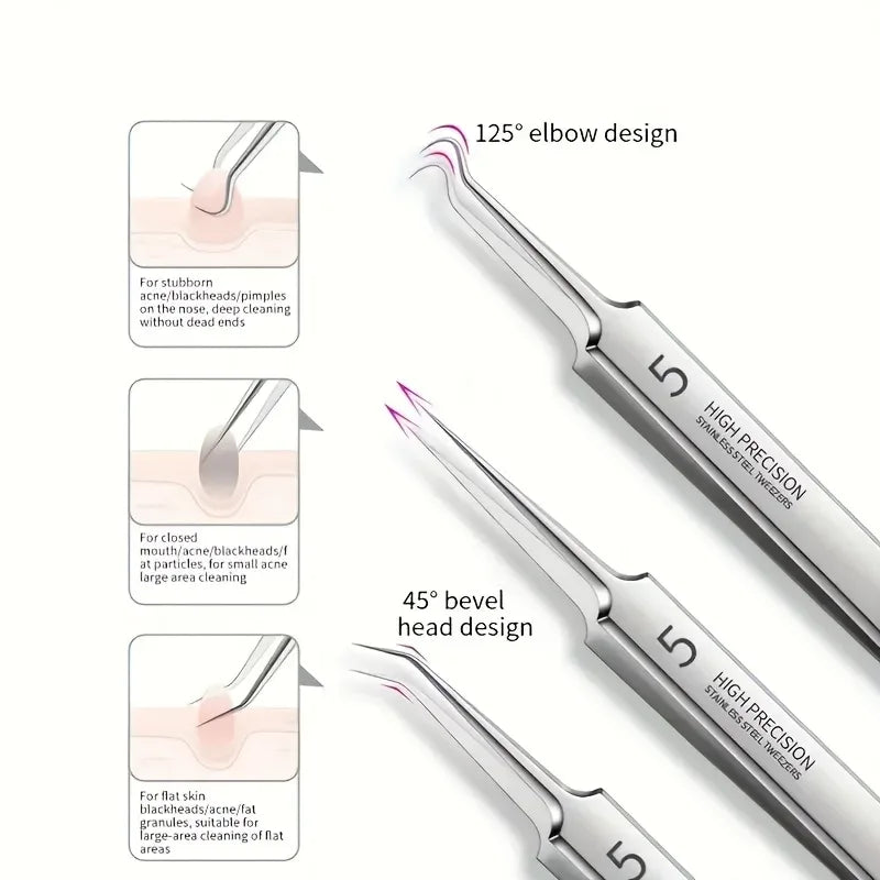 8-Piece Blackhead Remover Kit – Stainless Steel Blemish & Acne Extraction Tools – Professional Pimple Popper Set for All Skin