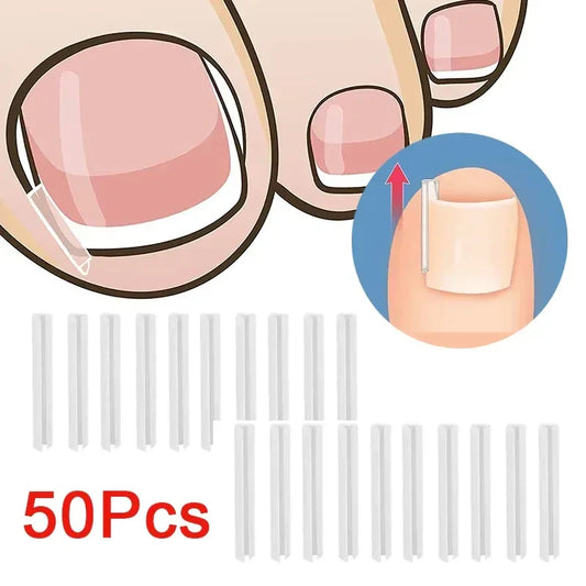 50Pcs Elastic Patch Sticker Pedicure Tool Ingrown Toenail Correction Tool Ingrown Toe Nail Treatment Straightening Clip Brace
