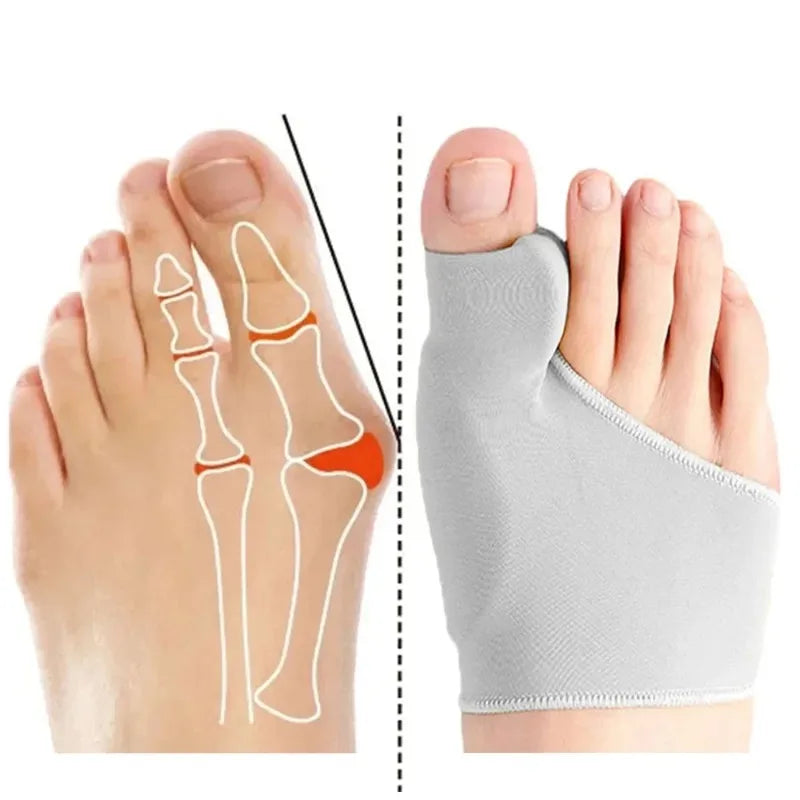 Hallux Valgus Bunion Corrector Toe Separator – Foot Alignment & Pain Relief