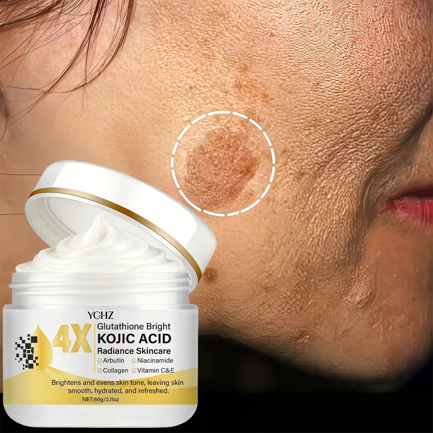 Kojic Acid Face Cream, Evens Out Skin Tone, Eliminates Dark Spots and Dullness - Non-Greasy, Suitable for Both Men and Women - Whitening and Moisturizing Cream, for Day and Night Use - 60g