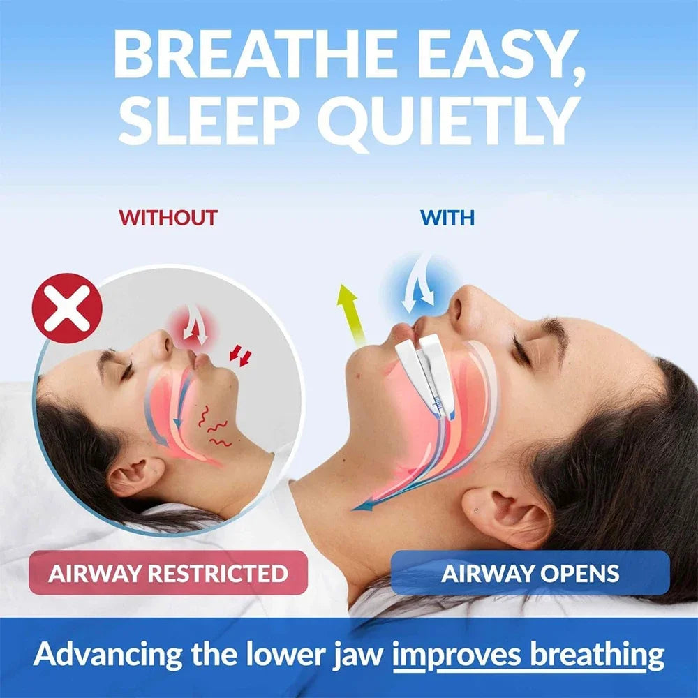Adjustable Anti-Snore Mouthpiece Sleeping Mouth Guard Stop Snoring Device Nighttime Teeth Protection And Bruxism Relief
