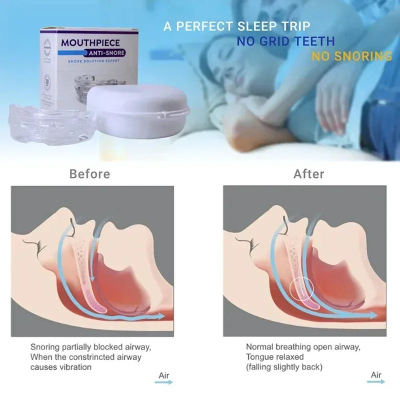 Teeth Bruxism Mouthguard – Sleep & Snore Aid